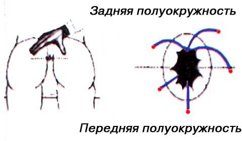 04-04