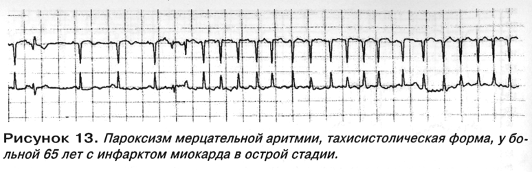 img 13