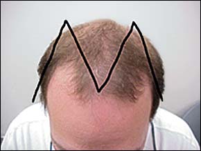 img 1