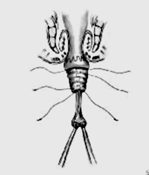 img 2