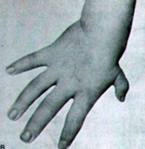 01-06