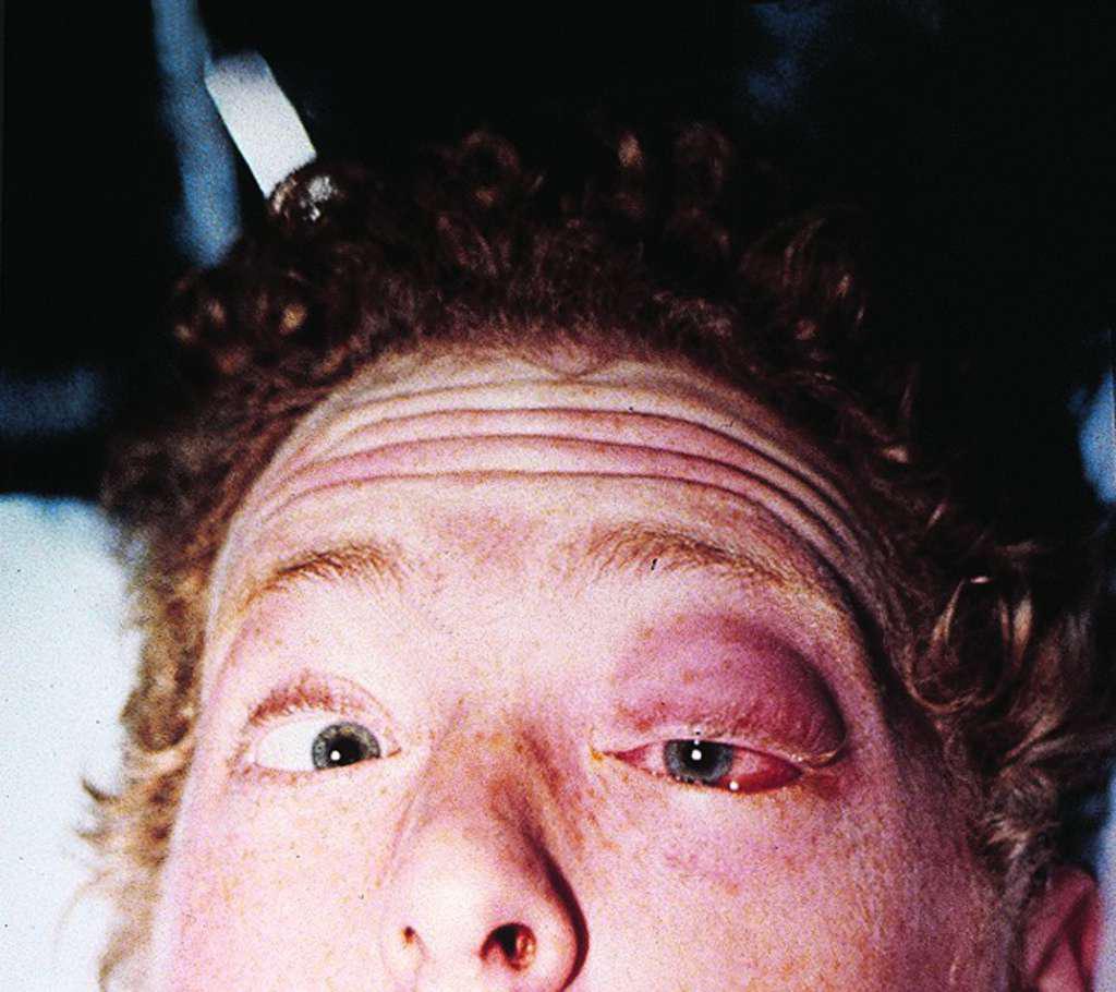 img 1