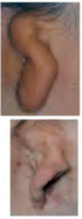 img 13-2