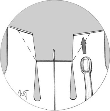 img 2